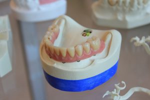 Ce este CAD/CAM în stomatologie și tehnica dentară?