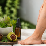 Remedii naturale pentru varice și circulație venoasă